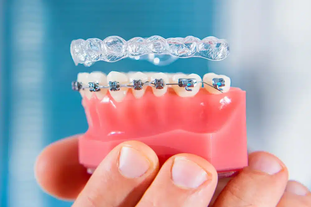 clear aligners honolulu hi